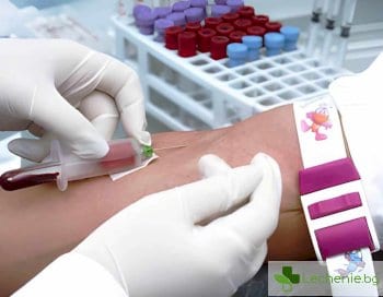 Значение на MPV кръвни изследвания